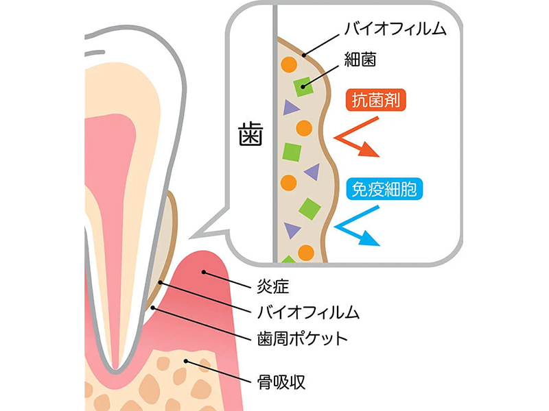 愛知県丹羽郡扶桑町の歯医者・わだち歯科クリニックの予防治療